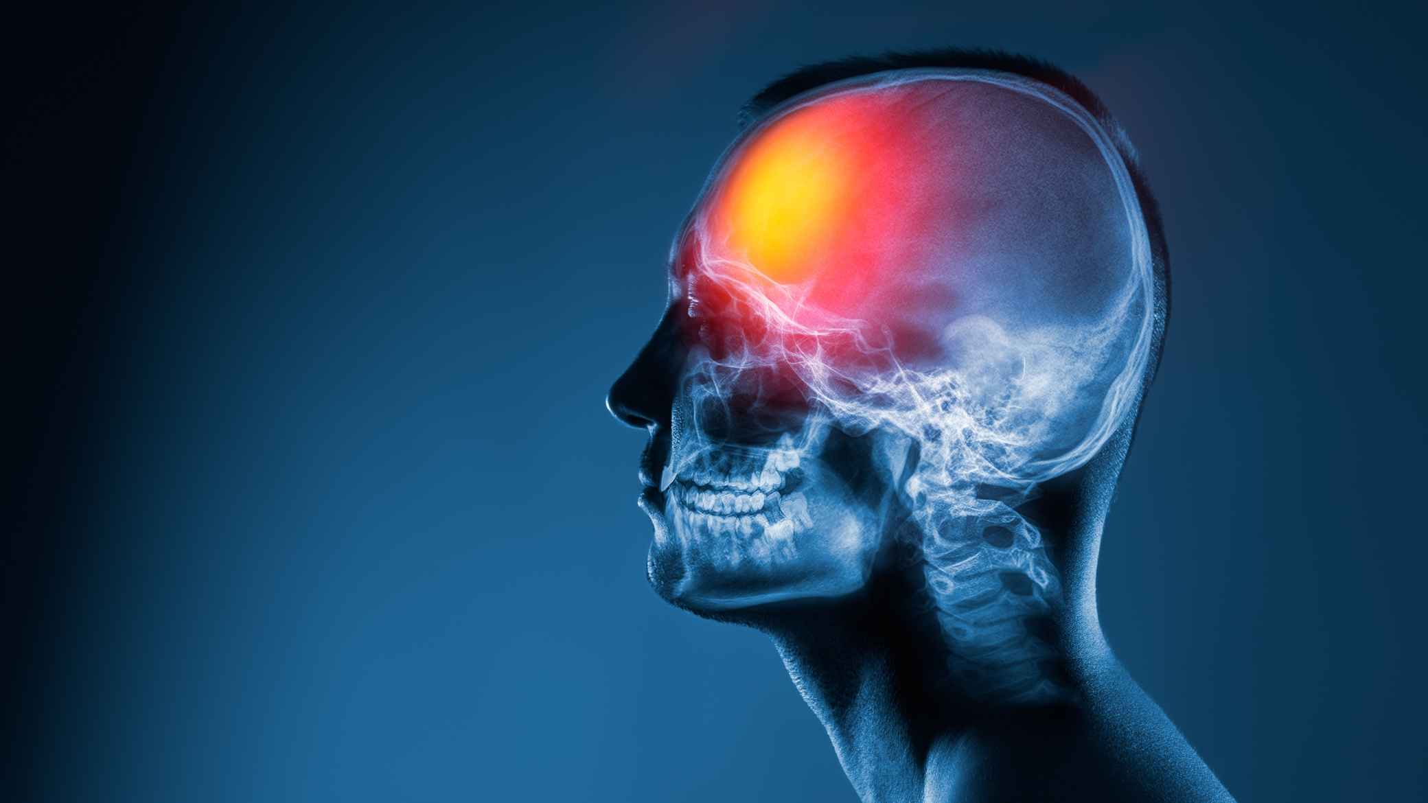 Refining Accuracy in Complex Head and Neck Claim Cycles​