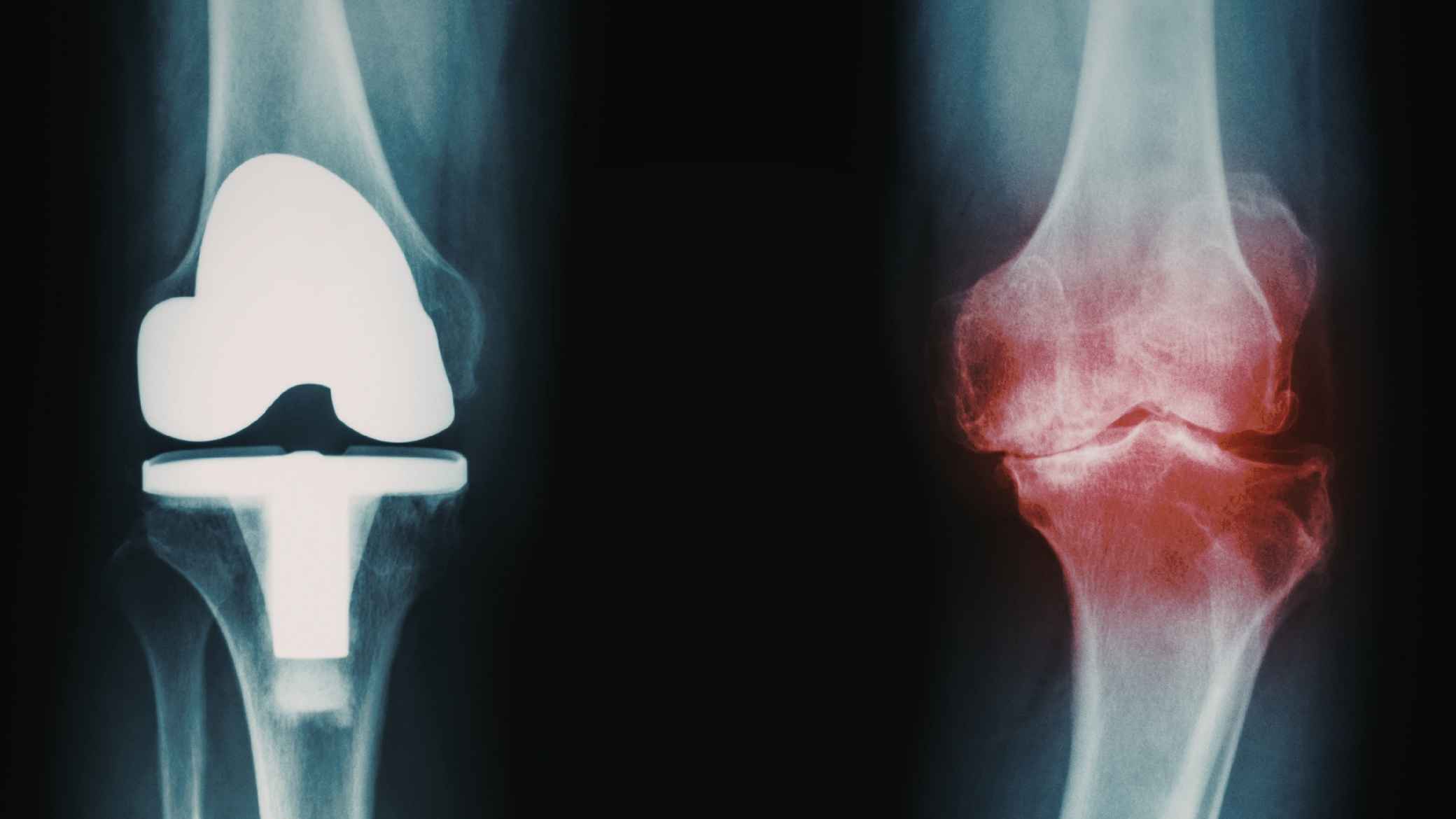 Accelerated Privileging for High-Growth Orthopedic Clinicians​