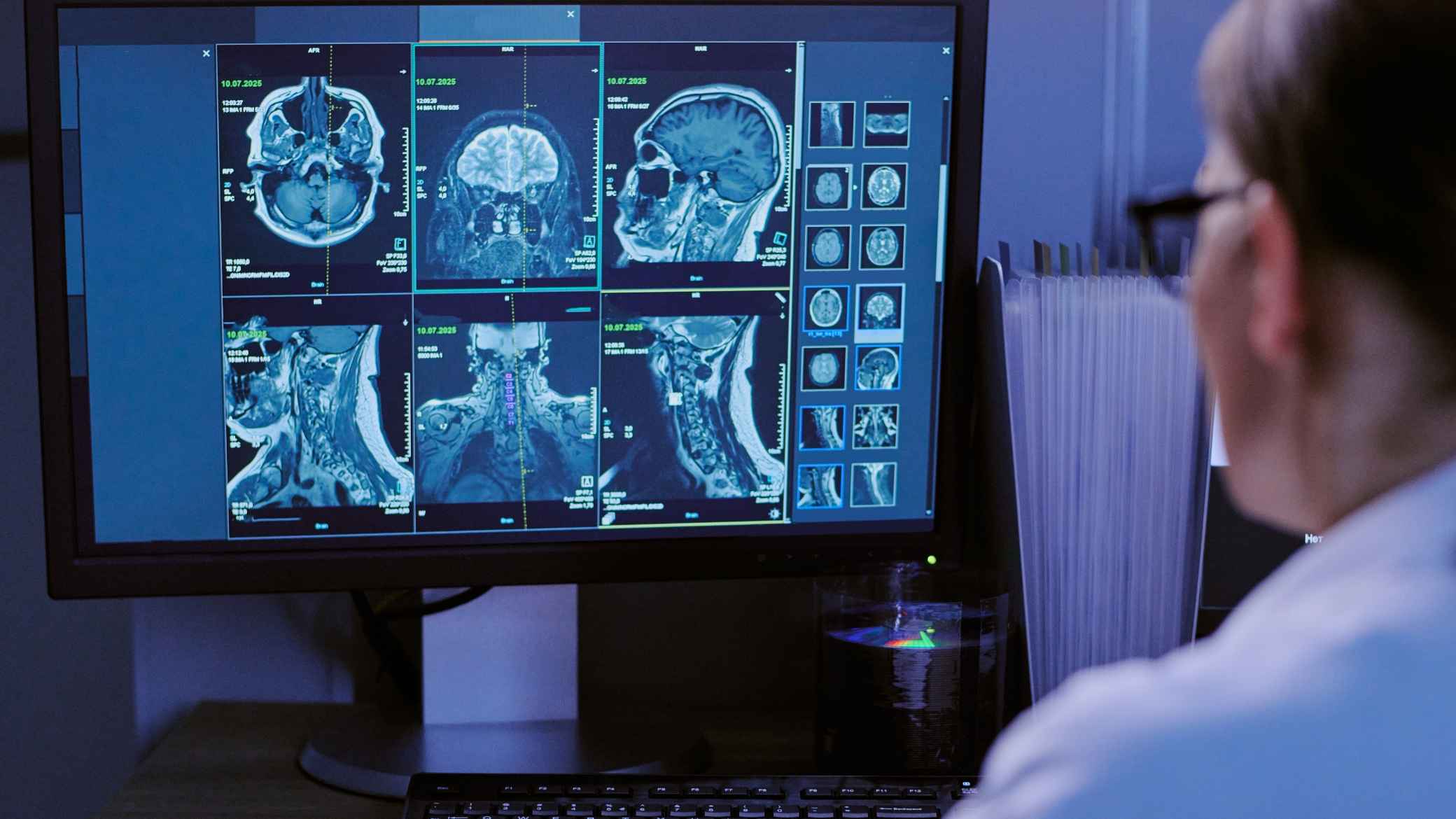 Sharpening Revenue Precision for Advanced Brain and Spine Facilities​